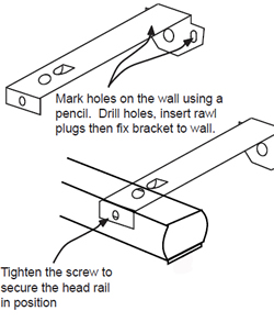 Face fix brackets